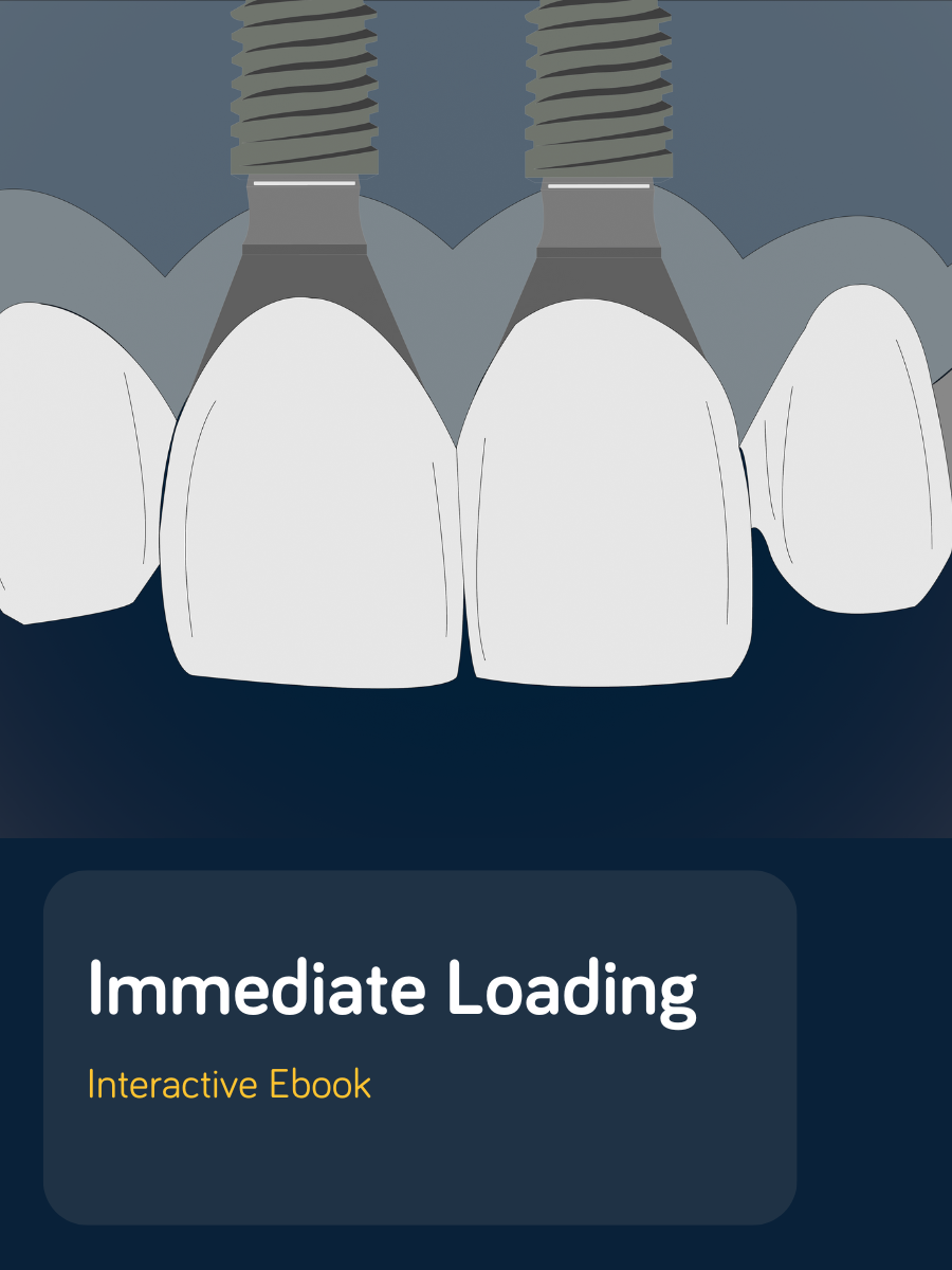 Immediate Loading
