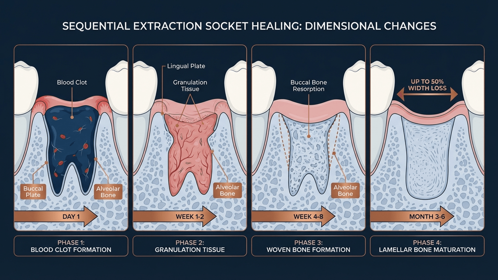 Socket healing phases showing bone remodeling progression