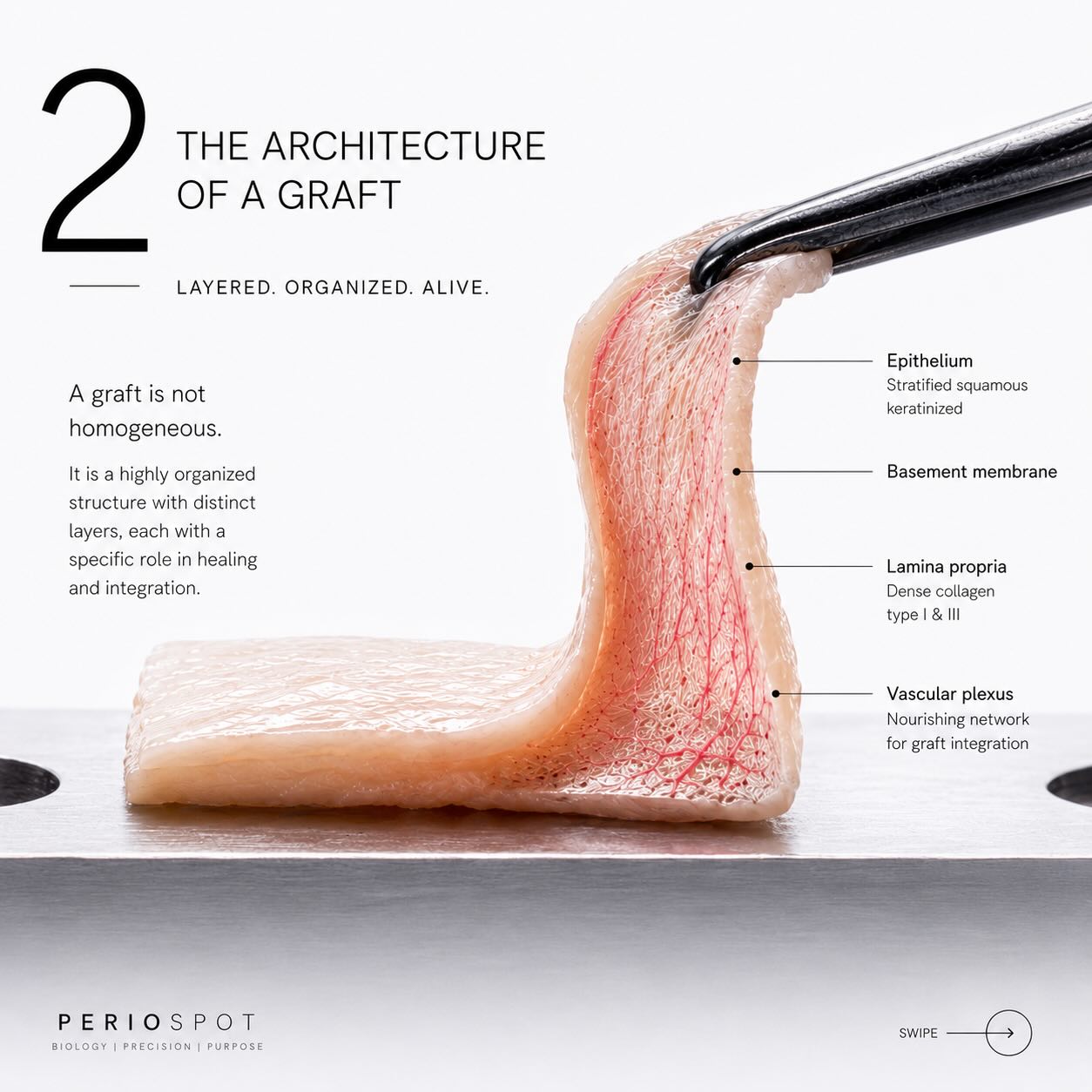 Five biological components of a connective tissue graft: epithelium, collagen bundles, vascular plexuses, fibroblasts and extracellular matrix