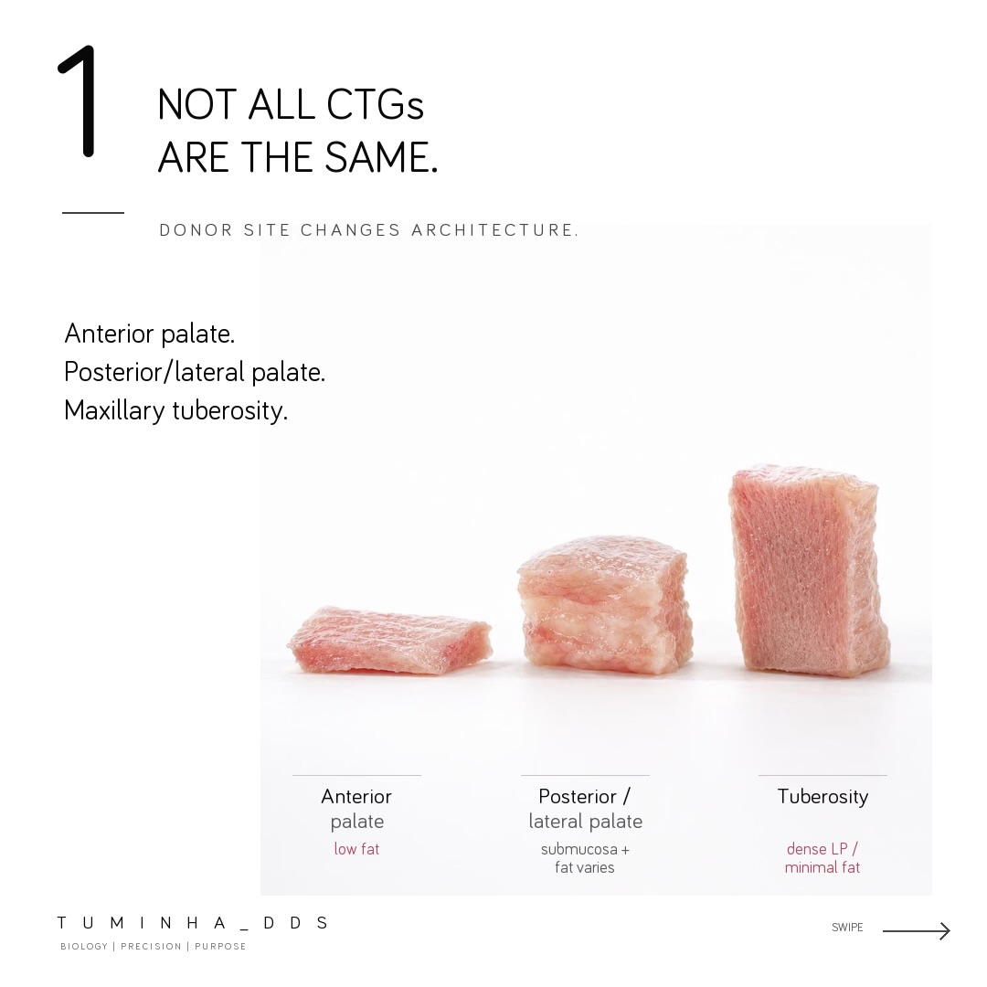 Three connective tissue graft specimens side by side: anterior palate (thin, low fat), posterior/lateral palate (submucosa and fat varies), and tuberosity (tallest, dense lamina propria, minimal fat).