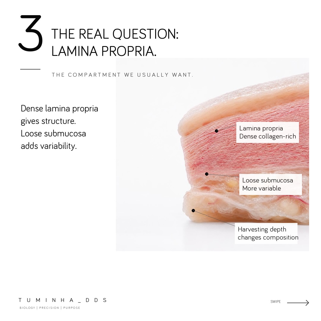 Cross-section of a connective tissue graft with the dense collagen-rich lamina propria on top and the looser, fattier submucosa below, illustrating that harvesting depth changes composition.