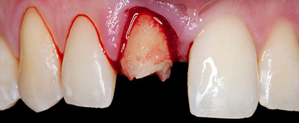 _dsc0003-crop-u32780