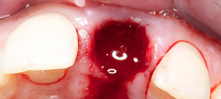 _dsc0004-crop-u32786