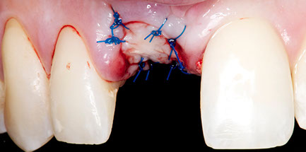 _dsc0011 (1)-crop-u32806