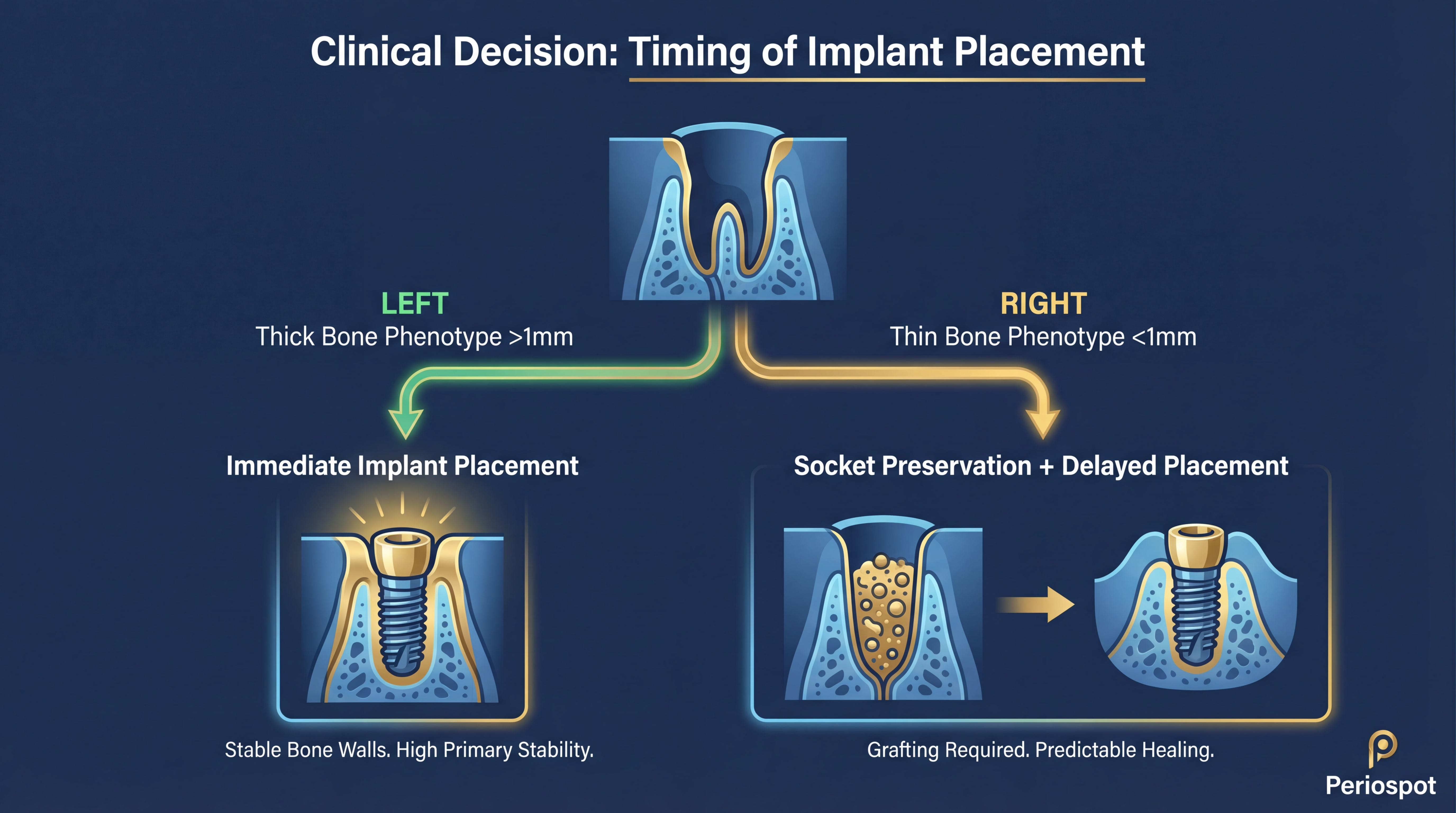 Clinical decision flowchart for immediate vs delayed implant placement based on bone phenotype