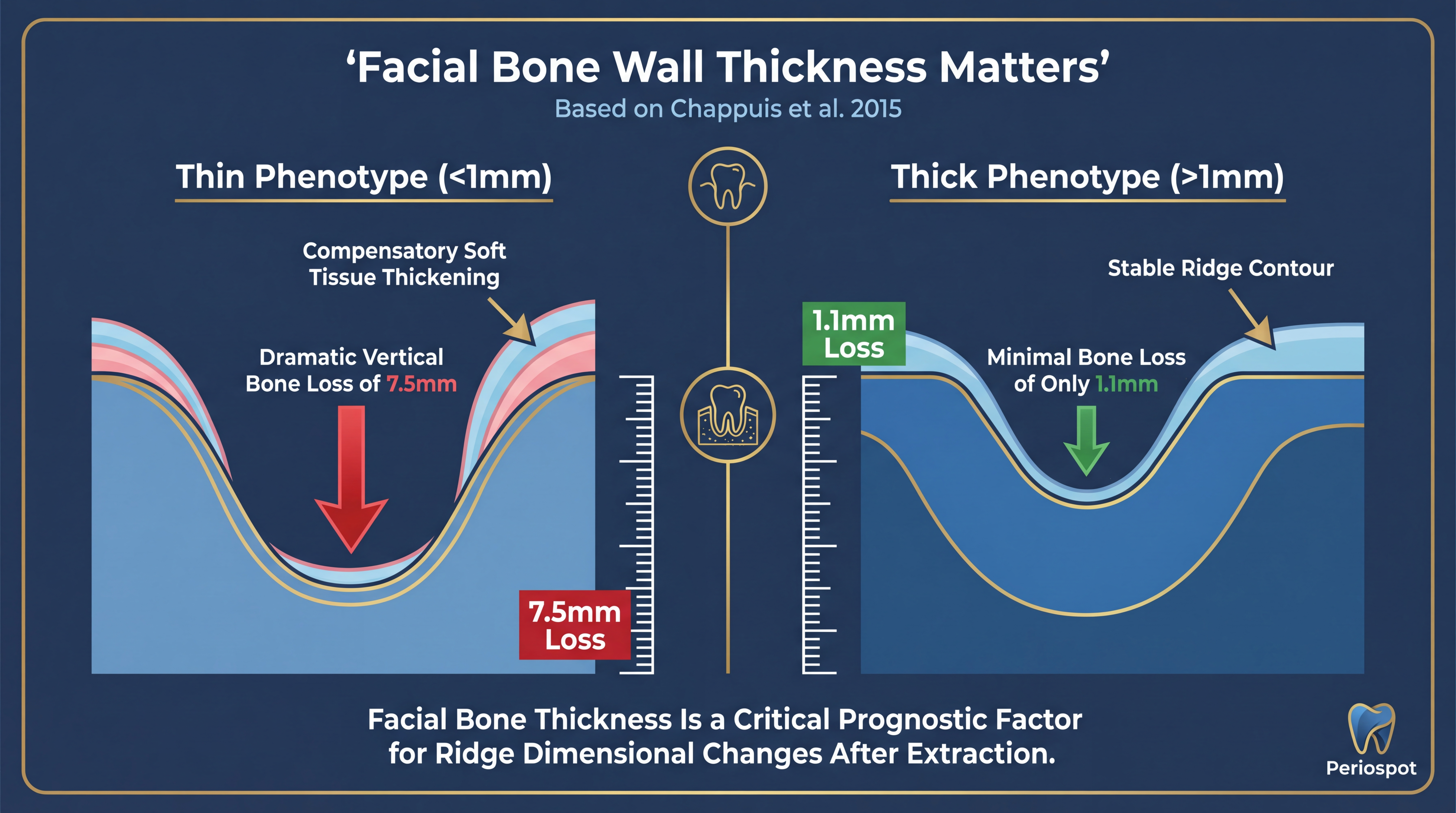 Comparison of thin vs thick bone phenotype after tooth extraction showing 7.5mm vs 1.1mm bone loss